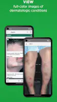 5-Minute Clinical Consult screenshot