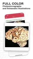 Board Review Series-Pathology screenshot