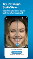 My Invisalign - Official App screenshot