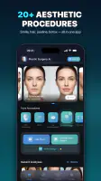 Nose Job - Plastic Surgery AI screenshot