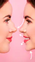 Rhinoplasty App: Nose Editor screenshot