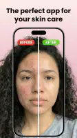 Skin Care Scanner: GlowUp screenshot